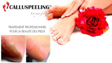 De jolies pieds grâce au calluspeeling